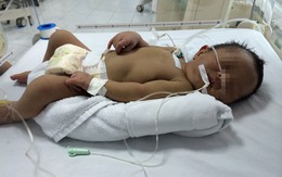 Bé sơ sinh vàng da do bất đồng nhóm máu với mẹ