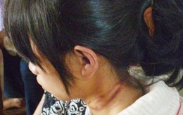 Rùng mình mẹ ruột nhẫn tâm hành hạ con gái tới mức tự tử