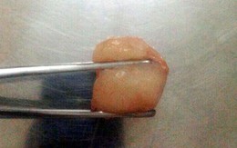 Hà Nội: Hóc vải, bé trai 6 tuổi tử vong thương tâm