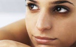 Lý do khiến mắt thâm quầng