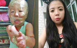 Cô giáo mầm non dùng băng dính dán mặt, trói tay bé trai