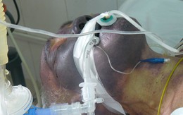 Ăn tiết canh lợn: Sướng một lần, mất một đời
