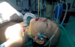 Cậu bé sống sót thần kì dù bị đũa đâm thẳng vào não