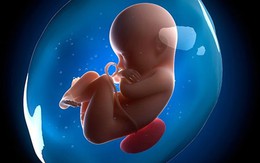 Hy hữu: Thai "đi lạc" sống trong ổ bụng hơn 2 tháng