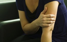 7 lý do khiến da bạn dễ bị bầm tím