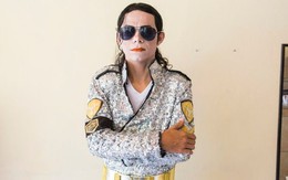 Người đàn ông tiêm axit lên mặt để có làn da trắng như... Michael Jackson
