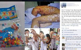 Phát hoảng với đồ chơi TQ phát nổ gây bỏng rộp, mẩn ngứa