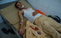 Lăn xả cứu người dân, CSGT bị côn đồ chém trọng thương