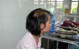 Bé gái 15 tuổi bị người tình của mẹ chém nứt sọ não
