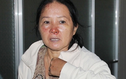 Tài xế xe du lịch gặp nạn đã chủ động đâm vào vách núi