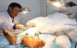Người đàn ông có tới hai "bàn chân phải"