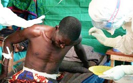 Cảnh báo virus '10 người nhiễm, 9 người tử vong' có thể trở thành đại dịch toàn cầu