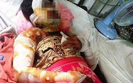 Thai phụ bị thiêu sống và nỗi buồn các cuộc tình chóng vánh