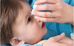 5 điều quan trọng cha mẹ cần làm khi bé bị đau mắt đỏ