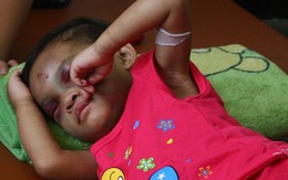 "Địa ngục" trần gian của bé 4 tuổi bị đánh đến biến dạng