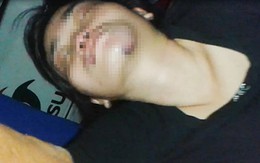 Bảo vệ khu phố ở Sài Gòn dùng dây siết cổ, đạp vợ ngất xỉu