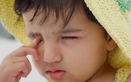 Vì sao mắt bé hay bị ghèn?