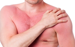 Hỏi đáp về bệnh dị ứng và cách chữa trị