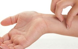 Ngứa không dám gãi bệnh gì?