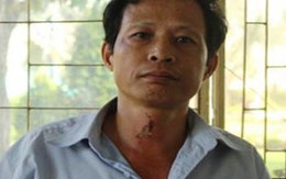 Khởi tố kẻ tạt axit cả một gia đình