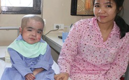 Em bé Việt Nam đầu tiên khỏi bệnh 'lột da ếch' nhờ ghép tủy