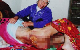 Lời kể kinh hoàng của người giúp việc bị chủ bạo hành 