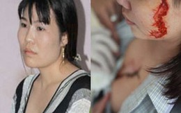 Bà chủ ép nhân viên xăm rết bị tạm giam 2 tháng