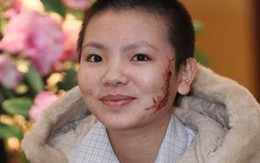 Gặp cô gái bị xăm rết trước ngày về quê 