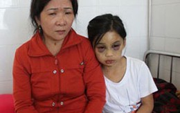 Bắt thêm mẹ nuôi hành hạ cháu bé 10 tuổi