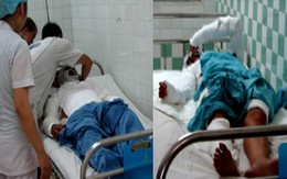 Đôi tình nhân bị tạt axít trong phòng trọ