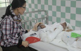 Đời nhiều éo le của nữ vệ sĩ bị người yêu dội axit