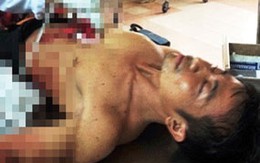 Sát hại nữ tiếp viên massage rồi tự tử 