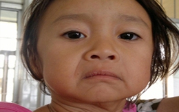 Bé 3 tuổi có khuôn mặt như bà già 60