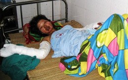 Thai phụ bị chồng thiêu sống ngay sau tuần trăng mật 