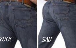 Nam nhi suýt chết vì bơm ngực, độn mông