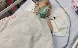 Bệnh nhân bị em trai cắt chân đã tỉnh