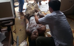 Một người đàn ông bị điện giật cháy sém 