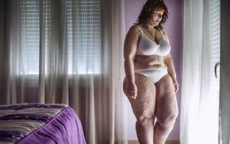 Quá trình giảm 55kg của cô gái nặng 124kg