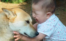 Bé 2 tuổi bị chó cắn vào mặt