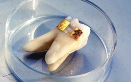 Thoát chết nhờ… xăm răng 