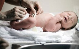 Bé sơ sinh nguy kịch vì uốn ván