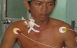 Ngư dân bị cá đâm thủng tim