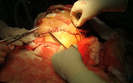 Cứu sống một bệnh nhân bị đứt vùng cổ