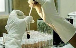 Xét nghiệm máu biết tình trạng ung thư 
