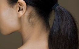Bắt bệnh dựa vào vị trí mọc mụn