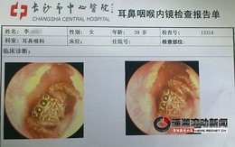 Nhện làm tổ trong tai một phụ nữ