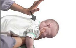 2 kỹ năng cấp cứu trẻ do dị vật