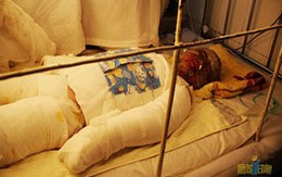 Xúc động bé 7 tuổi lao vào đám cháy cứu mẹ