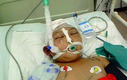 Bị đánh dã man, bé 5 tuổi hôn mê hơn 10 ngày chưa tỉnh 