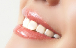 5 cách bảo vệ răng miệng khỏe mạnh